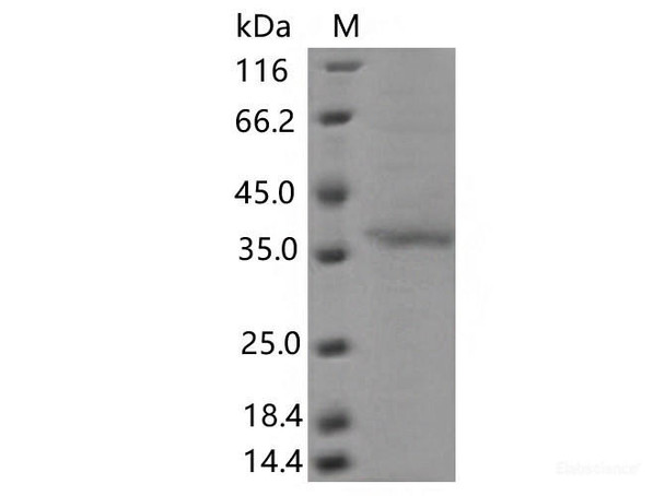 Recombinant SARS-CoV-2 Spike RBD (G446V) (His Tag)