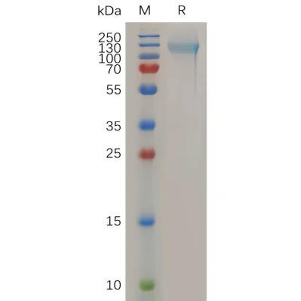 Human NCL Protein, His Tag (HDPT0651)