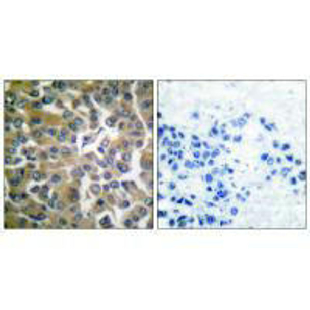 FAP Polyclonal Antibody (PACO65150)_3