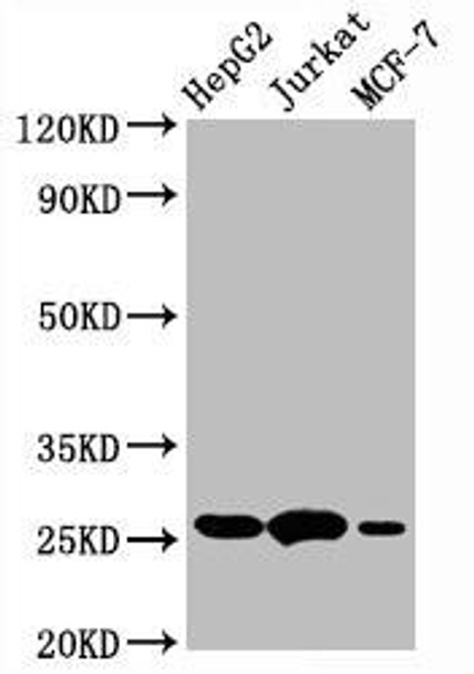BCL2 Recombinant Monoclonal Antibody (RACO0592)