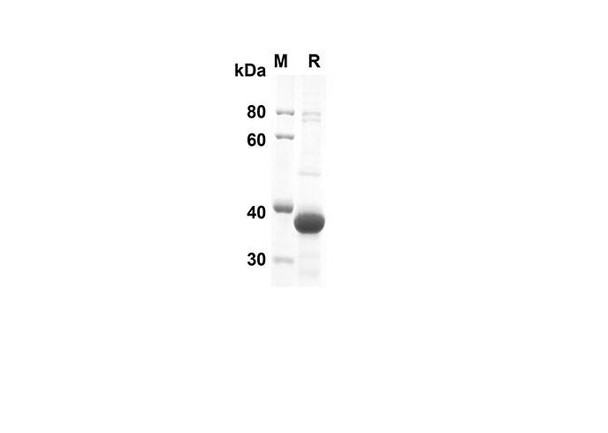 Recombinant Human FGF4 Protein(Trx Tag) (RPES8004) Recombinant Human FGF4 Protein(Trx Tag) (RPES8004)