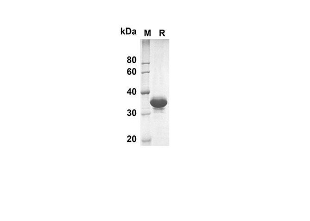 Recombinant Human DAND5 Protein(Trx Tag) (RPES8011)