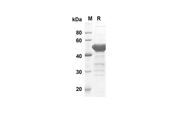 Recombinant Human CDH1 Protein(Trx Tag) (RPES8012) Recombinant Human CDH1 Protein(Trx Tag) (RPES8012)