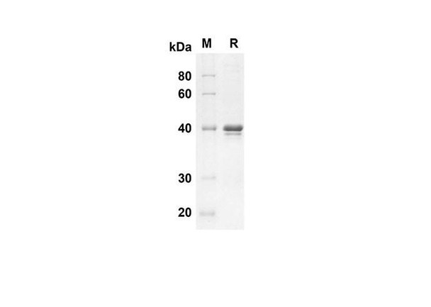 Recombinant Human HSP-27 Protein(Sumo Tag) (RPES8031)
