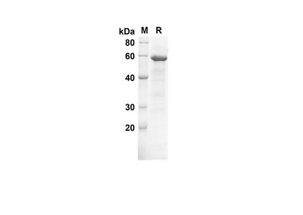 Recombinant Human Beclin-1 Protein(Trx Tag) (RPES8060)