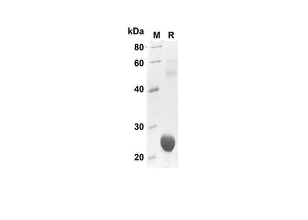 Recombinant Human CXCL7/NAP-2 Protein(Sumo Tag) (RPES8076)