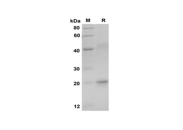Recombinant Human OXA Protein(Sumo Tag) (RPES8080) Recombinant Human OXA Protein(Sumo Tag) (RPES8080)