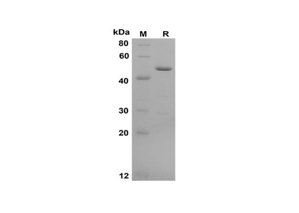 Recombinant Human Galectin-3 Protein(Gst Tag) (RPES8086)