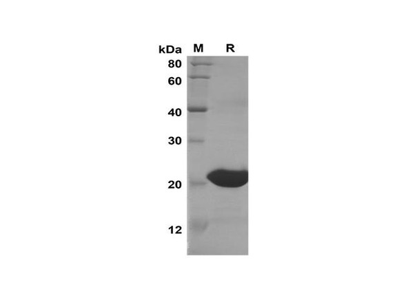 Recombinant Human ENHO Protein(Trx Tag) (RPES8091) Recombinant Human ENHO Protein(Trx Tag) (RPES8091)