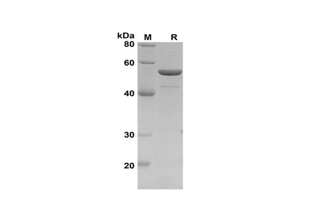 Recombinant Human GAP43 Protein(Sumo Tag) (RPES8118)