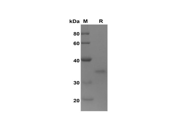 Recombinant Human CD3E T3E Protein(Trx Tag) (RPES8131) Recombinant Human CD3E T3E Protein(Trx Tag) (RPES8131)