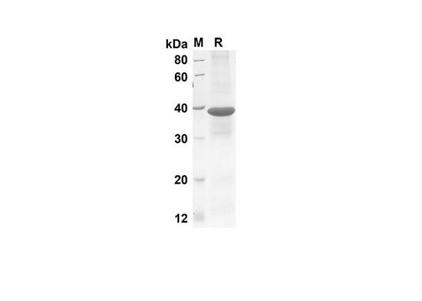 Recombinant Mouse CCL3 Protein(Gst Tag) (RPES8159)
