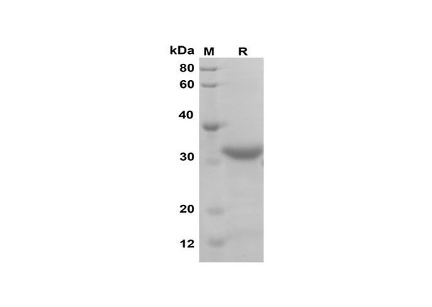 Recombinant Mouse PROK1 Protein(Trx Tag) (RPES8198)