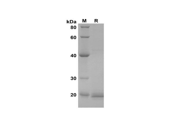 Recombinant Mouse Epiregulin Protein(Sumo Tag) (RPES8208)