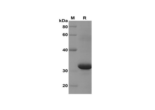 Recombinant Mouse CCL9/10/MIP-1Î³ Protein(Sumo Tag) (RPES8213)