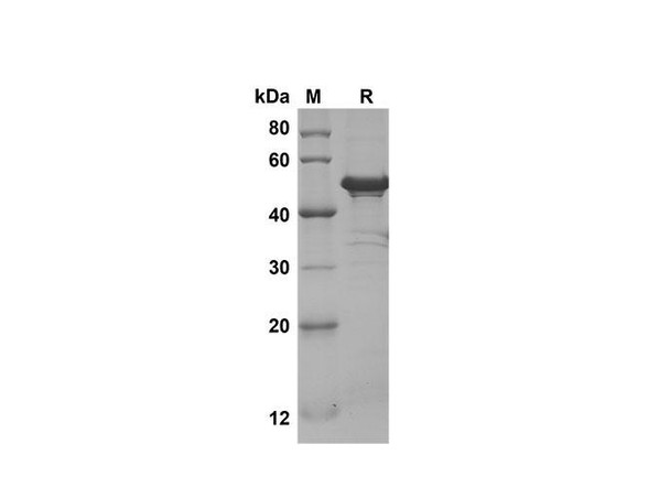 Recombinant Mouse IL-11 Protein(Trx Tag) (RPES8215)