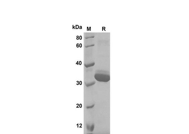 Recombinant Rat Cystatin C Protein(Trx Tag) (RPES8239)