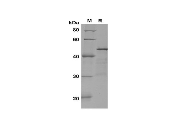 Recombinant Rat IL-21 Protein(Gst Tag) (RPES8245)