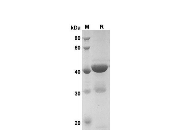 Recombinant Rat MIF Protein(Gst Tag) (RPES8249)