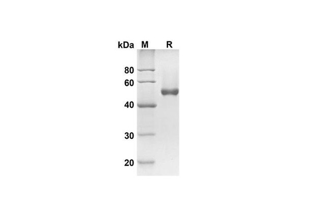Recombinant Human CD23 Protein( Fc Tag) (RPES8256)