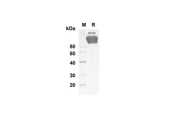 Recombinant Human KDR Protein( Fc Tag) (RPES8258) Recombinant Human KDR Protein( Fc Tag) (RPES8258)