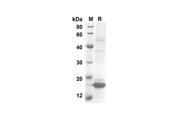 Recombinant Human IL10 Protein(His Tag) (RPES8261) Recombinant Human IL10 Protein(His Tag) (RPES8261)