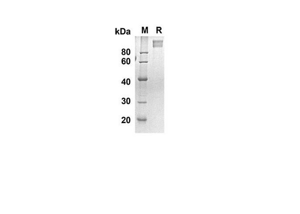 Recombinant Human MAG Protein(Fc Tag) (RPES8277)