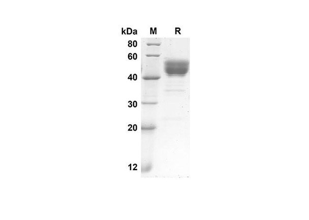 Recombinant Human GM-CSF Protein( Fc Tag) (RPES8285)