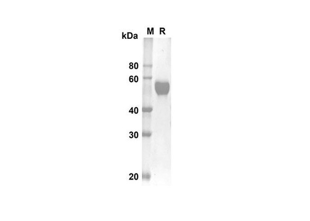 Recombinant Human TNFRSF9 Protein (Fc Tag) (RPES8300)