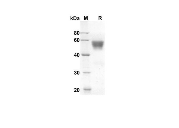 Recombinant human FLT3LG Protein (Fc Tag) (RPES8315)