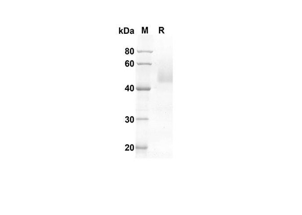 Recombinant Human FASL Protein (Fc Tag) (RPES8316)