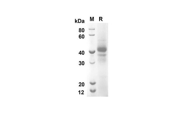 Recombinant Human BMP6 Protein (Fc Tag) (RPES8319)