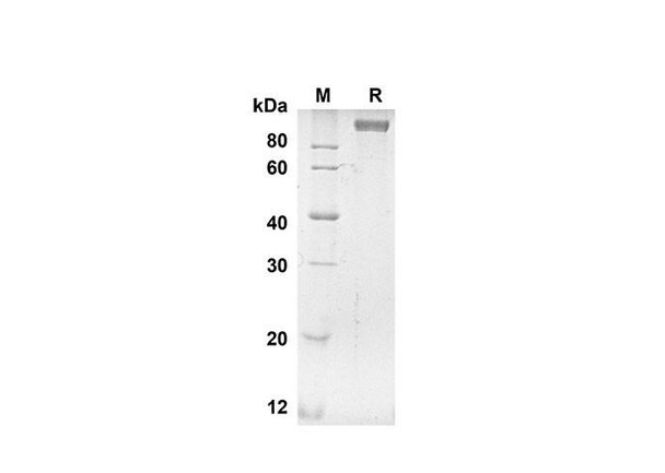 Recombinant Human ANPEP Protein (His Tag) (RPES8322)