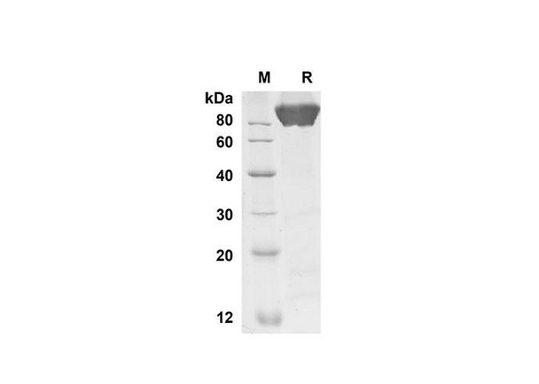Recombinant Human SELE Protein (His Tag) (RPES8330)