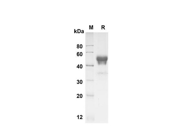 Recombinant Human ALK-1 Protein (Fc Tag) (RPES8348)