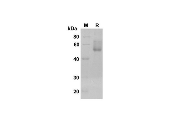 Recombinant Human DKK-3 Protein (His Tag) (RPES8360)