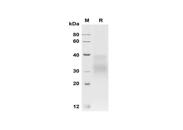 Recombinant Human HVEM/TNFRSF14 Protein (His Tag) (RPES8380)
