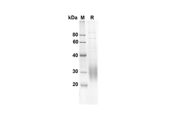 Recombinant Mouse Tnfrsf18 Protein (His Tag) (RPES8425)