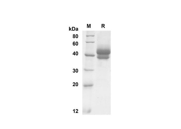 Recombinant Mouse TSLP Protein (Fc Tag) (RPES8458)