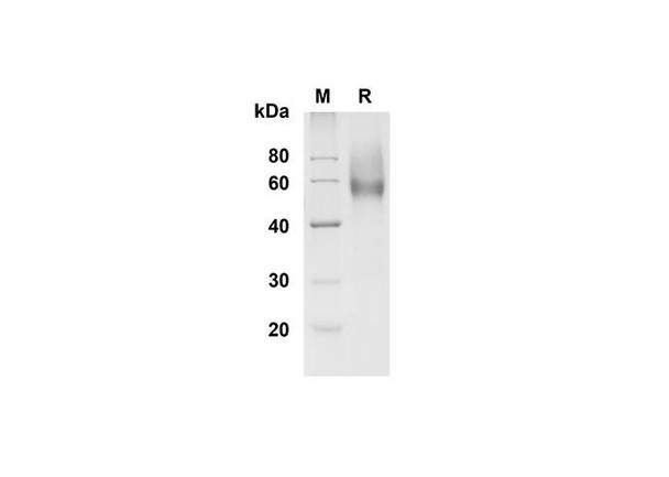 Recombinant Mouse L-Selectin/CD62L Protein (His Tag) (RPES8465)