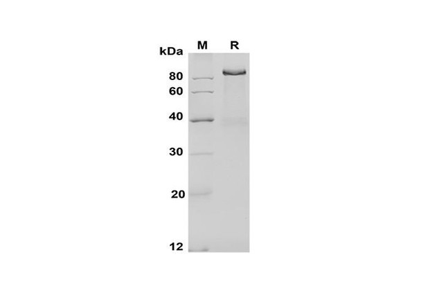 Recombinant Mouse Dll4 Protein (Fc Tag) (RPES8494)