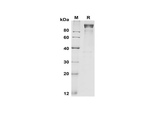 Recombinant Mouse G-CSF R/CD114 Protein (Fc Tag) (RPES8503)