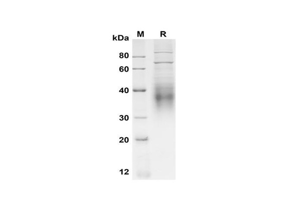 Recombinant Mouse CD30 Ligand/TNFSF8 Protein (His Tag) (RPES8510)