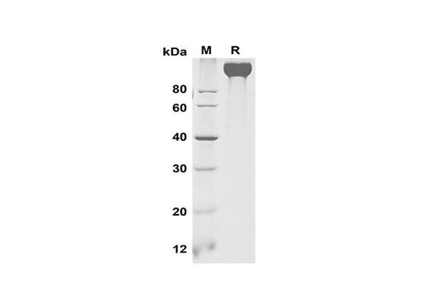 Recombinant Mouse VEGF R2/Flk-1 Protein (Fc Tag) (RPES8512)