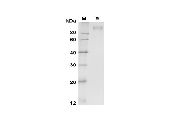 Recombinant Mouse E-Selectin/CD62E Protein (Fc Tag) (RPES8513)