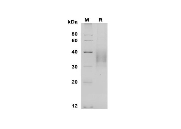 Recombinant Rat CD48/SLAMF2 Protein (His Tag) (RPES8538)
