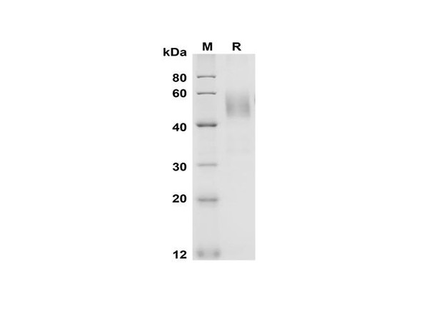 Recombinant Rat Fas/TNFRSF6/CD95 Protein (Fc Tag) (RPES8539)