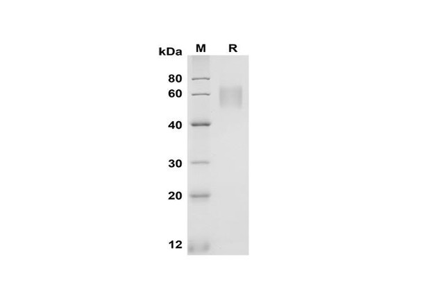 Recombinant Rat FcÎ³ RIIB/CD32b Protein (Fc Tag) (RPES8541)
