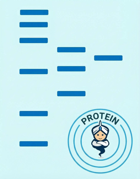 Recombinant Human S100A11 protein (His Tag) (RPES8591)