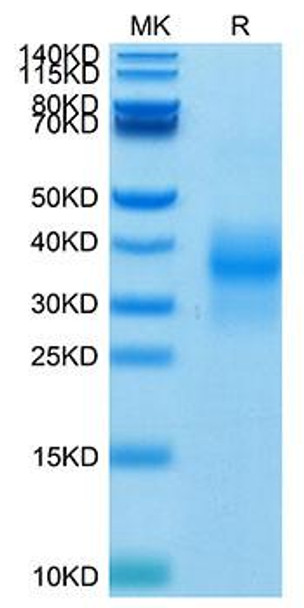 Biotinylated Recombinant Human NKG-2D/KLRK1/CD314 Protein (RPCB0049)